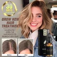 Hair Loss Products Treatment Natural Grow Hair Essence Oil Faster Regrowth Hair Growth Products Help for hair Growth Hair Care